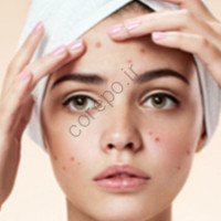 آیا کرم نرم کننده باعث جوش می‌شود؟